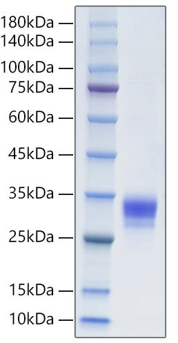 Recombinant Human CTHRC1 Protein was determined by SDS-PAGE under reducing conditions with Coomassie Blue.