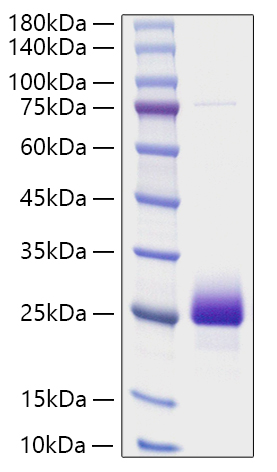 Recombinant Human NBL1 Protein was determined by SDS-PAGE under reducing conditions with Coomassie Blue.