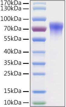 Recombinant Mouse Vitronectin/V75/VTN Protein was determined by SDS-PAGE under reducing conditions with Coomassie Blue.