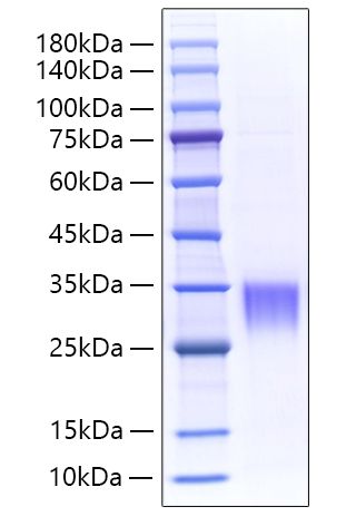 Recombinant Mouse Asprosin/Fibrillin-1/FBN1 Protein was determined by SDS-PAGE under reducing conditions with Coomassie Blue.