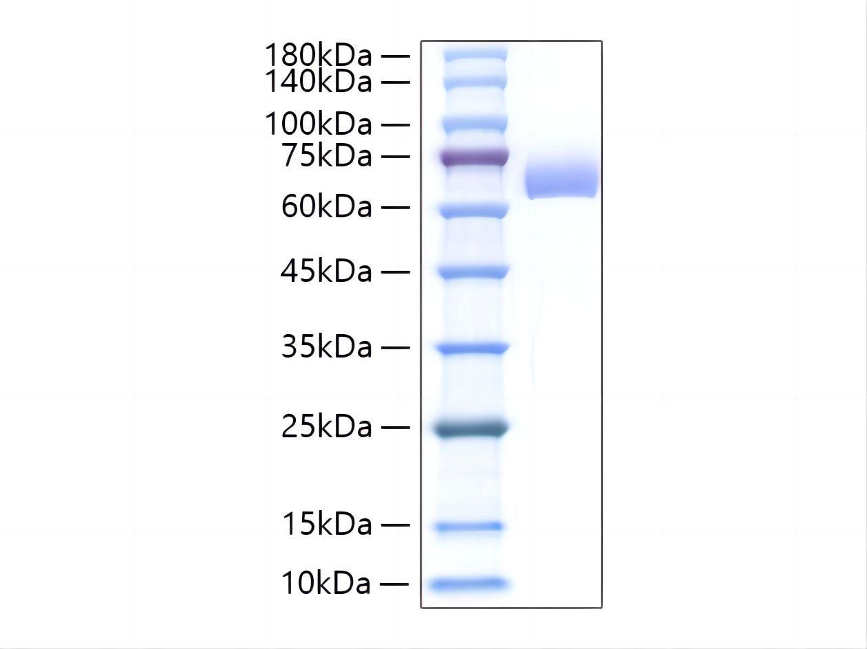 Recombinant Mouse Alkaline phosphatase (Intestinal type)/ALPI Protein was determined by SDS-PAGE under reducing conditions with Coomassie Blue.