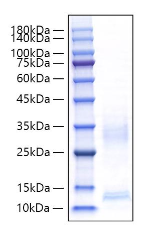 Recombinant Mouse CXCL9/MIG Protein was determined by SDS-PAGE under reducing conditions with Coomassie Blue.