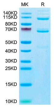 Recombinant Human Complement C3 Protein was determined by SDS-PAGE under reducing conditions with Coomassie Blue.