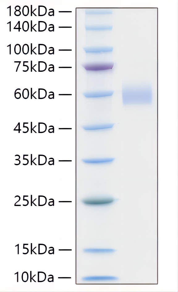 Recombinant Human Lp-PLA2/PLA2G7 Protein was determined by SDS-PAGE under reducing conditions with Coomassie Blue.
