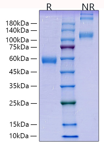 Recombinant Human Placenta growth factor/PlGF-131/PlGF-1 Protein was determined by SDS-PAGE under reducing (R) and non-reducing (NR) conditions.