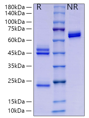 Recombinant Mouse IL-23/IL-12B&amp;IL-23A Protein was determined by SDS-PAGE under reducing (R) and non-reducing (NR) conditions.