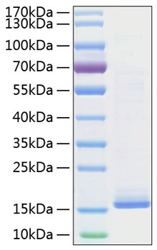 Recombinant Mouse IL-22 Protein was determined by SDS-PAGE under reducing conditions with Coomassie Blue.