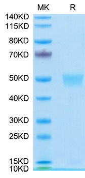 Recombinant Human LRG1 Protein was determined by SDS-PAGE under reducing conditions with Coomassie Blue.