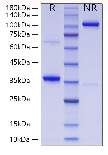 Recombinant Human Collagen II alpha 1/COL2A1 Protein was determined by SDS-PAGE under reducing conditions with Coomassie Blue.