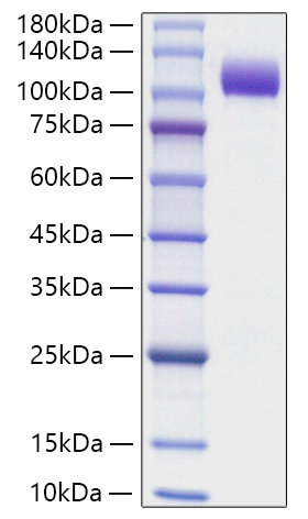 Recombinant Human NCAM-1/CD56 Protein was determined by SDS-PAGE under reducing conditions with Coomassie Blue.