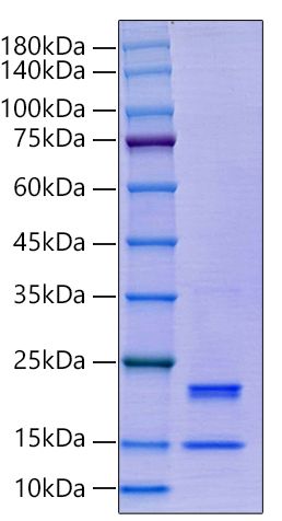 Recombinant Human Caspase-7/CASP7 Protein was determined by SDS-PAGE under reducing conditions with Coomassie Blue.