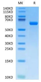 Recombinant Human Alkaline Phosphatase (Germ type) /ALPG Protein was determined by SDS-PAGE under reducing conditions with Coomassie Blue.