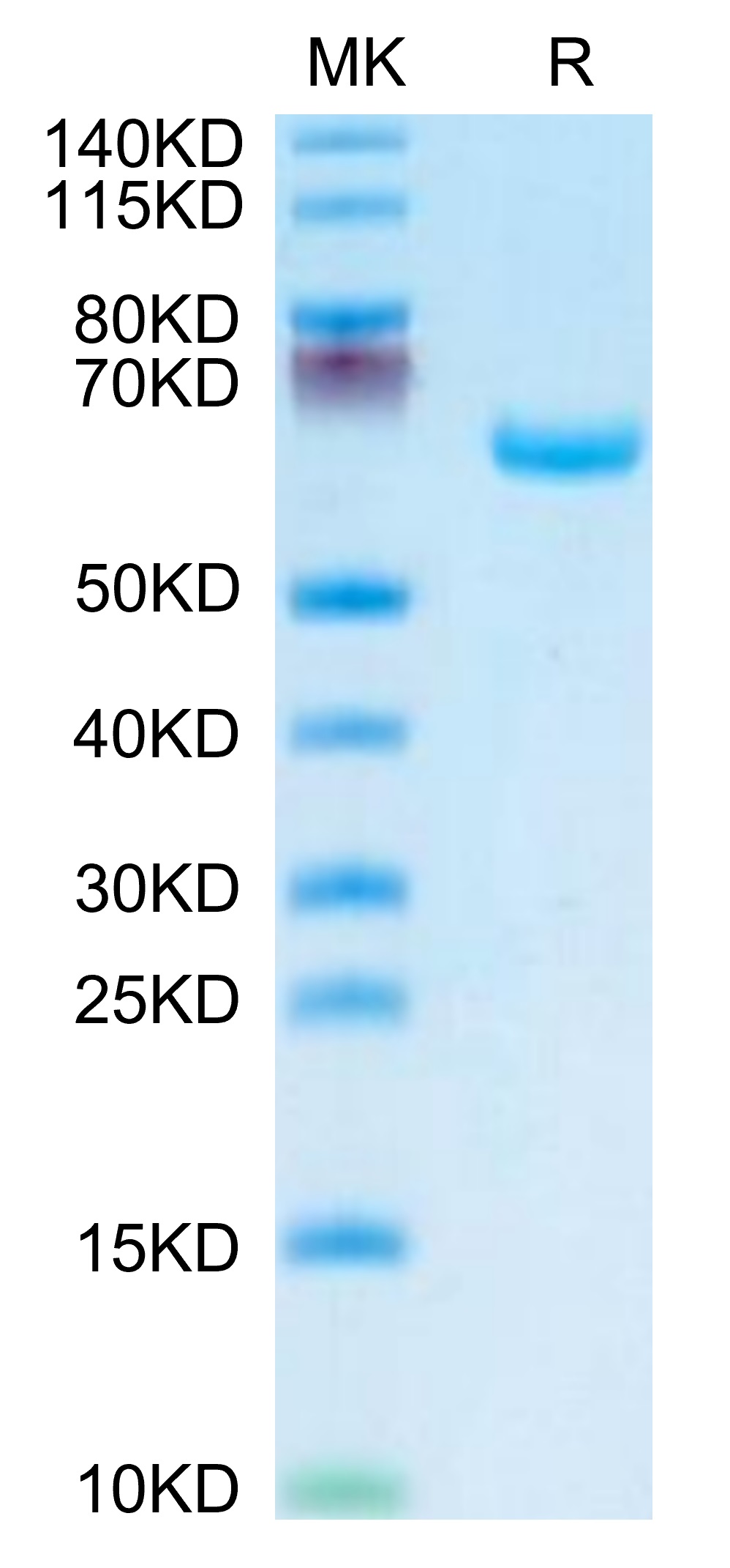 Recombinant Human Alkaline phosphatase (Placental type) /ALPP Protein was determined by SDS-PAGE under reducing conditions with Coomassie Blue.