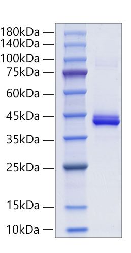 Recombinant Mouse CXCL4/PF-4 Protein was determined by SDS-PAGE under reducing conditions with Coomassie Blue.
