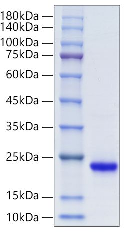 Recombinant Mouse FGF-7/HBGF-7/KGF Protein was determined by SDS-PAGE under reducing conditions with Coomassie Blue.