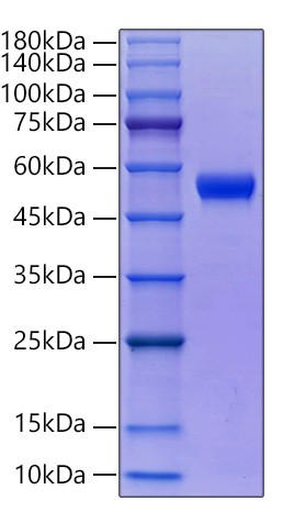 Recombinant Human Thy-1/CD90 Protein was determined by SDS-PAGE under reducing conditions with Coomassie Blue.