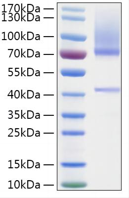 Recombinant Human HGF Activator/HGFA Protein was determined by SDS-PAGE under reducing conditions with Coomassie Blue.