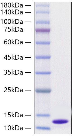 Recombinant Human CXCL6 Protein was determined by SDS-PAGE under reducing conditions with Coomassie Blue.