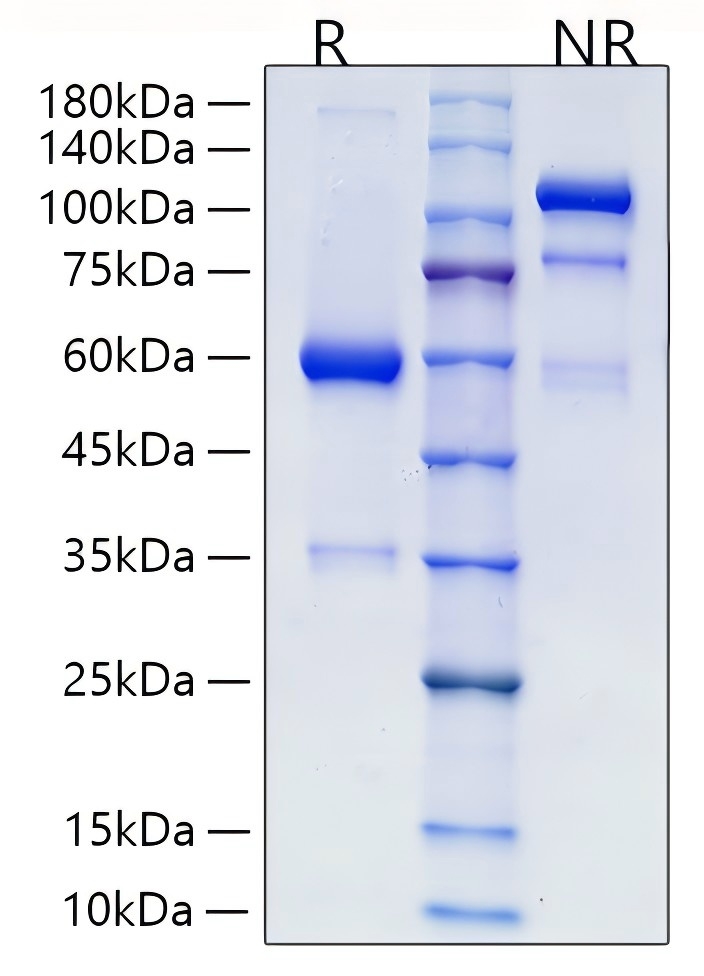 Recombinant Human R-spondin-2/RSPO2 Protein was determined by SDS-PAGE under reducing (R)