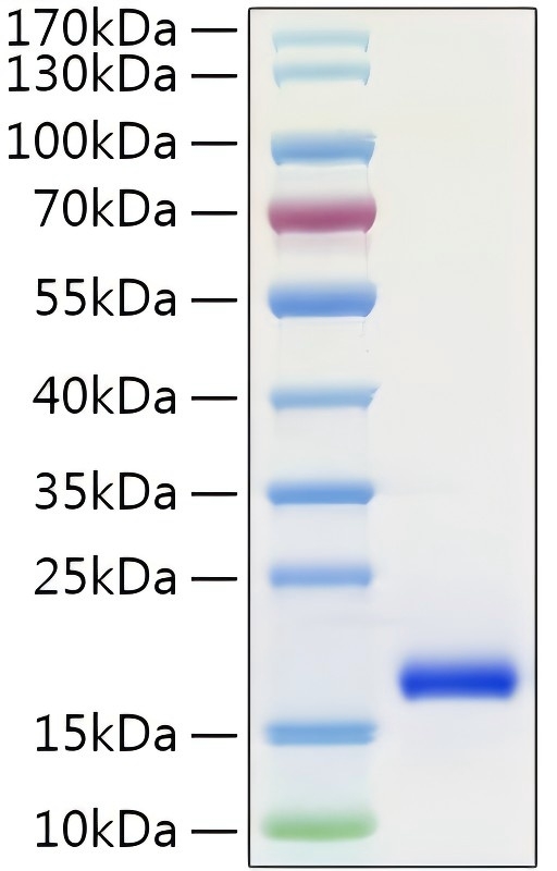 Recombinant Human IL-1 alpha Protein was determined by SDS-PAGE under reducing conditions with Coomassie Blue.