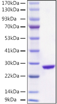 Recombinant Aequorea victoria EGFP Protein was determined by SDS-PAGE under reducing conditions with Coomassie Blue.