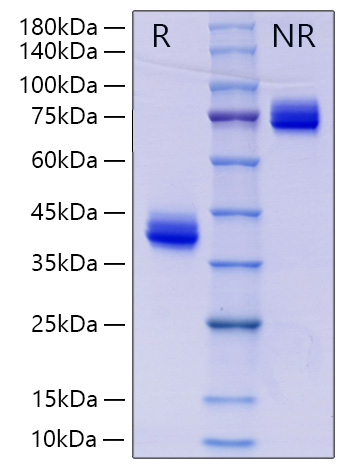 Recombinant Human IgG3 Protein was determined by SDS-PAGE under reducing (R) and non-reducing (NR) conditions.