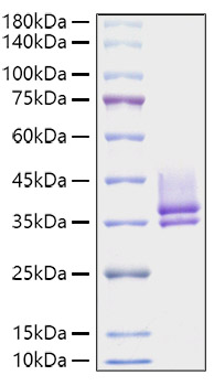Recombinant Serratia marcescens Nuclease was determined by SDS-PAGE under reducing conditions with Coomassie Blue.