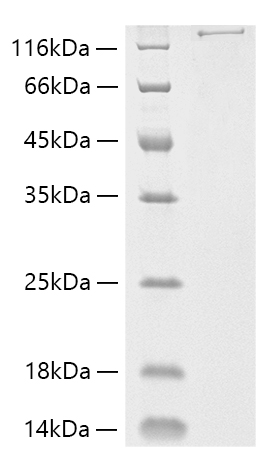 Recombinant Streptococcus pyogenes M1 Cas9 Protein was determined by SDS-PAGE under reducing conditions with Coomassie Blue.