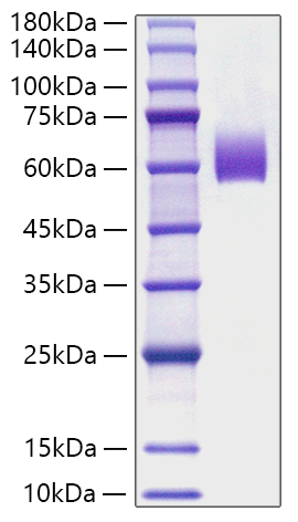 Recombinant Mouse IgE Protein was determined by SDS-PAGE under reducing conditions with Coomassie Blue.