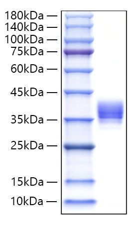 Recombinant Human IgM Protein was determined by SDS-PAGE under reducing conditions with Coomassie Blue.