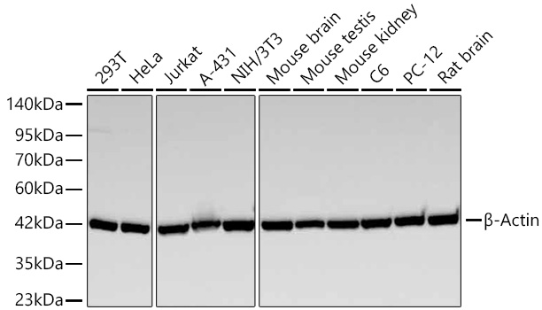 Western blot analysis of various lysates using β-Actin Mouse mAb (AC004) at 1:22000 dilution incubated overnight at 4℃.|Secondary antibody: HRP-conjugated Goat anti-Mouse IgG (H+L) (AS003) at 1:10000 dilution.|Lysates/proteins: 25 μg per lane.|Blocking buffer: 3% nonfat dry milk in TBST.|Detection: ECL Basic Kit (RM00020).|Exposure time: 60 s.