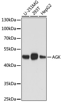 Western blot analysis of various lysates using AGK Mouse mAb at 1:1000 dilution.|Secondary antibody: HRP-conjugated Goat anti-Mouse IgG (H+L) at 1:10000 dilution.|Lysates/proteins: 25μg per lane.|Blocking buffer: 3% nonfat dry milk in TBST.|Detection: ECL Basic Kit.|Exposure time: 5s.