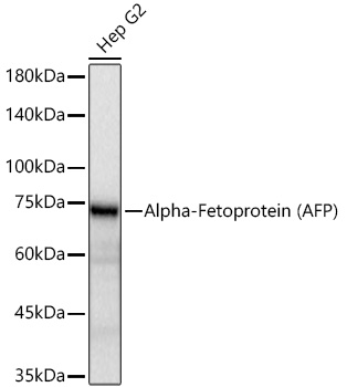 Western blot analysis of lysates from Hep G2 cells using Alpha-Fetoprotein (AFP) Mouse mAb (A11865) at 1:1000 dilution incubated overnight at 4℃.|Secondary antibody: HRP-conjugated Goat anti-Mouse IgG (H+L) (AS003) at 1:10000 dilution.|Lysates/proteins: 25 μg per lane.|Blocking buffer: 3% nonfat dry milk in TBST.|Detection: ECL Basic Kit (RM00020).|Exposure time: 10s.