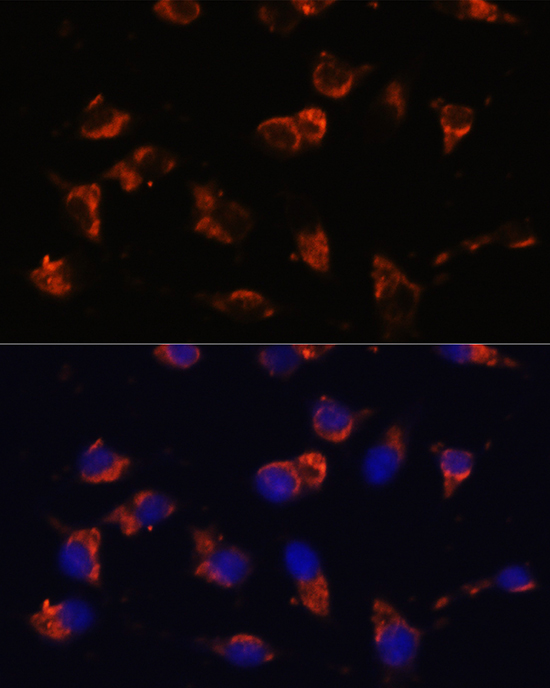 Immunofluorescence analysis of SW480 cells using CA19-9 Mouse mAb at dilution of 1:100. Blue: DAPI for nuclear staining.
