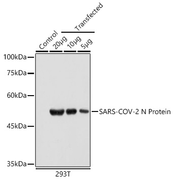Western blot analysis of from wild type (WT) and 293T cells transfected with SARS-CoV-2 N Protein using SARS-CoV-2 N Protein Mouse mAb at 1:1000 dilution.|Secondary antibody: HRP-conjugated Goat anti-Mouse IgG (H+L) at 1:10000 dilution.|Lysates/proteins: 20μg/10μg/5μg per lane.|Blocking buffer: 3% nonfat dry milk in TBST.|Detection: ECL Basic Kit.|Exposure time: 5s.