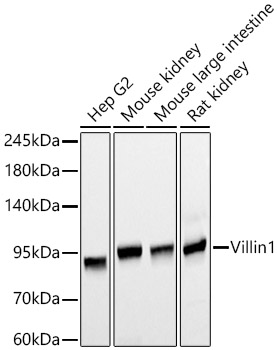 Western blot analysis of various lysates, using Villin1 Mouse mAb (A20545) at 1:1000 dilution.|Secondary antibody: HRP-conjugated Goat anti-Mouse IgG (H+L) (AS003) at 1:10000 dilution.|Lysates/proteins: 25μg per lane.|Blocking buffer: 3% nonfat dry milk in TBST.|Detection: ECL Basic Kit (RM00020).|Exposure time: 30s.