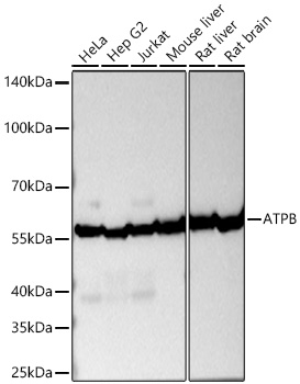 Western blot analysis of various lysates using ATPB Mouse mAb at 1:10000 dilution incubated overnight at 4℃.|Secondary antibody: HRP-conjugated Goat anti-Mouse IgG (H+L) at 1:10000 dilution.|Lysates/proteins: 25 μg per lane.|Blocking buffer: 3% nonfat dry milk in TBST.|Detection: ECL Basic Kit.|Exposure time: 60s.