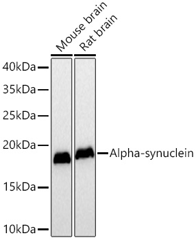 Western blot analysis of various lysates using [KO Validated] Alpha-synuclein Mouse mAb at 1:5000 dilution incubated overnight at 4℃.|Secondary antibody: HRP-conjugated Goat anti-Mouse IgG (H+L) at 1:10000 dilution.|Lysates/proteins: 25 μg per lane.|Blocking buffer: 3% nonfat dry milk in TBST.|Detection: ECL Basic Kit.|Exposure time: 90 s.