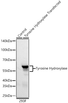 Western blot analysis of lysates from wild type (WT) and 293F cells transfected with Tyrosine Hydroxylase using Tyrosine Hydroxylase Mouse mAb (A28028) at 1:5000 dilution incubated overnight at 4℃.|Secondary antibody: HRP-conjugated Goat anti-Mouse IgG (H+L) (AS003) at 1:10000 dilution.|Lysates/proteins: 20 μg per lane.|Blocking buffer: 3% nonfat dry milk in TBST.|Detection: ECL Basic Kit (RM00020)|.Exposure time: 45 s.