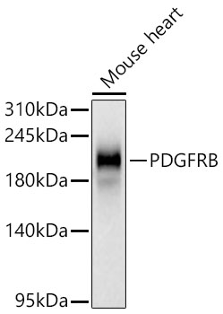 Western blot analysis of lysates from Mouse heart using PDGFRB Rabbit mAb at 1:1000 dilution incubated overnight at 4℃.|Secondary antibody: HRP-conjugated Goat anti-Rabbit IgG (H+L) at 1:10000 dilution.|Lysates/proteins: 25 μg per lane.|Blocking buffer: 3% nonfat dry milk in TBST.|Detection: ECL Basic Kit.|Exposure time: 30s.