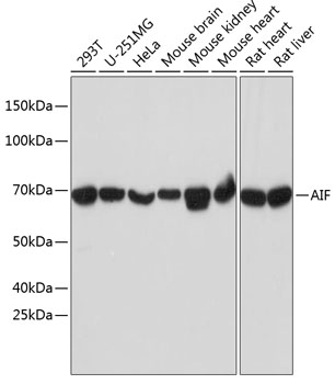 Western blot analysis of various lysates using AIF Rabbit mAb at 1:1000 dilution.|Secondary antibody: HRP-conjugated Goat anti-Rabbit IgG (H+L) at 1:10000 dilution.|Lysates/proteins: 25μg per lane.|Blocking buffer: 3% nonfat dry milk in TBST.|Detection: ECL Basic Kit.|Exposure time: 30s.