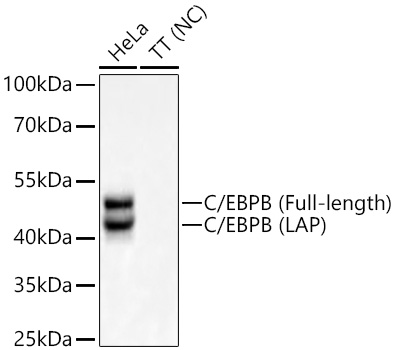 Western blot analysis of various lysates using C/EBPB Rabbit mAb at 1:1000 dilution incubated overnight at 4℃.|Secondary antibody: HRP-conjugated Goat anti-Rabbit IgG (H+L) at 1:10000 dilution.|Lysates/proteins: 25 μg per lane.|Blocking buffer: 3% nonfat dry milk in TBST.|Detection: ECL Basic Kit.|Negative control (NC): TT.|Exposure time: 20 s.