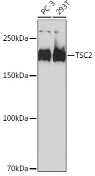 Western blot analysis of various lysates using TSC2 Rabbit mAb (A19540) at 1:1000 dilution.|Secondary antibody: HRP-conjugated Goat anti-Rabbit IgG (H+L) (AS014) at 1:10000 dilution.|Lysates/proteins: 25μg per lane.|Blocking buffer: 3% nonfat dry milk in TBST.|Detection: ECL Basic Kit (RM00020).|Exposure time: 90s.