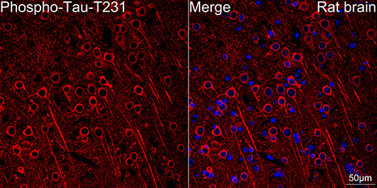 Confocal imaging of paraffin-embedded Rat brain tissue using Phospho-Tau-T231 Rabbit mAb followed by a further incubation with Cy3 Goat Anti-Rabbit IgG (H+L) (Red). DAPI was used for nuclear staining (Blue). Objective: 40x. Perform microwave antigen retrieval with 0.01 M citrate buffer (pH 6.0) prior to IF staining.