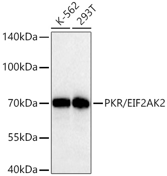 Western blot analysis of various lysates using PKR/EIF2AK2 Rabbit mAb at 1:2000 dilution incubated overnight at 4℃.|Secondary antibody: HRP-conjugated Goat anti-Rabbit IgG (H+L) at 1:10000 dilution.|Lysates/proteins: 25 μg per lane.|Blocking buffer: 3% nonfat dry milk in TBST.|Detection: ECL Basic Kit.|Exposure time: 30 s.