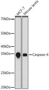 Western blot analysis of various lysates using Caspase-6 Rabbit mAb at 1:1000 dilution.|Secondary antibody: HRP-conjugated Goat anti-Rabbit IgG (H+L) at 1:10000 dilution.|Lysates/proteins: 25μg per lane.|Blocking buffer: 3% nonfat dry milk in TBST.|Detection: ECL Basic Kit.|Exposure time: 3min.