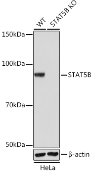 Western blot analysis of lysates from wild type (WT) and STAT5B knockout (KO) HeLa cells, using [KO Validated] STAT5B Rabbit mAb (A19567) at 1:1000 dilution.|Secondary antibody: HRP-conjugated Goat anti-Rabbit IgG (H+L) (AS014) at 1:10000 dilution.|Lysates/proteins: 25μg per lane.|Blocking buffer: 3% nonfat dry milk in TBST.|Detection: ECL Basic Kit (RM00020).|Exposure time: 1s.
