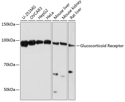 Western blot analysis of various lysates using Glucocorticoid Receptor Rabbit mAb at 1:1000 dilution.|Secondary antibody: HRP-conjugated Goat anti-Rabbit IgG (H+L) at 1:10000 dilution.|Lysates/proteins: 25μg per lane.|Blocking buffer: 3% nonfat dry milk in TBST.|Detection: ECL Basic Kit.|Exposure time: 30s.