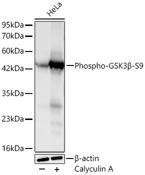 Western blot analysis of lysates from HeLa cells using Phospho-GSK3β-S9 Rabbit mAb at 1:3000 dilution incubated at room temperature for 1.5 hours. HeLa cells were treated with Calyculin A (100 nM) at 37℃ for 30 minutes after serum-starvation overnight.|Secondary antibody: HRP-conjugated Goat anti-Rabbit IgG (H+L) at 1:10000 dilution.|Lysates/proteins: 30 μg per lane.| Blocking buffer: 3% nonfat dry milk in TBST.| Detection: ECL Basic Kit.| Exposure time: 20s.