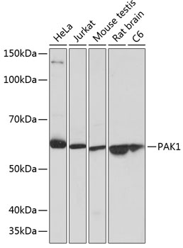 Western blot analysis of various lysates using PAK1 Rabbit mAb at 1:1000 dilution.|Secondary antibody: HRP-conjugated Goat anti-Rabbit IgG (H+L) at 1:10000 dilution.|Lysates/proteins: 25μg per lane.|Blocking buffer: 3% nonfat dry milk in TBST.|Detection: ECL Basic Kit.|Exposure time: 1s.